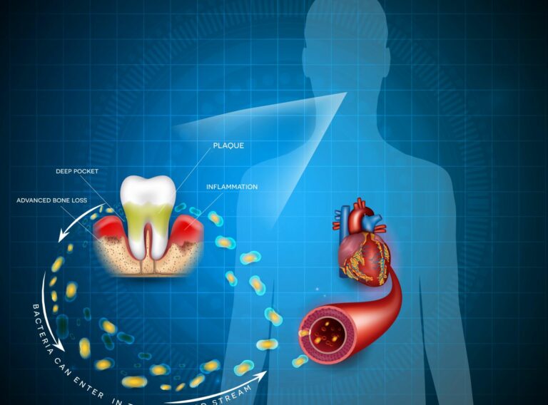 corps-humain-hygiène-buccodentaire-gencives-saignements-des gencives-santé-générale-neopulse-dentaire-min corps-humain-hygiène-buccodentaire-gencives-saignements-des gencives-santé-générale-neopulse-dentaire-min